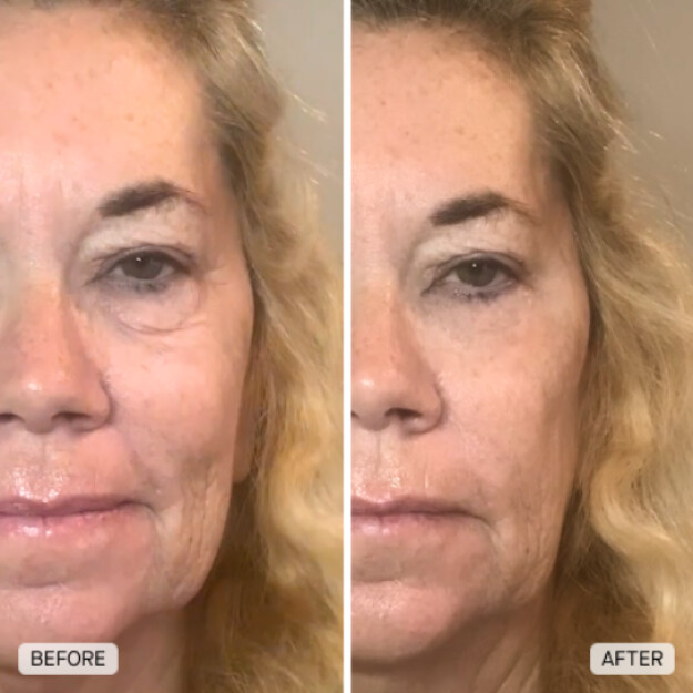 power rewind eye tightener