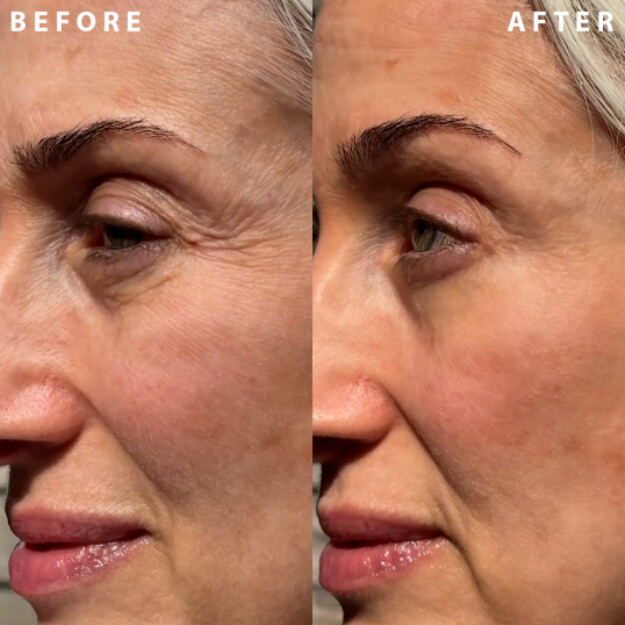 power redo wrinkle fix