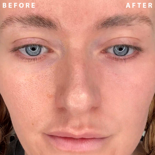 power redo wrinkle fix